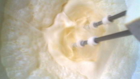 мороженоерижская классика