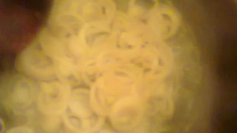 салат из свеклы с яблоком